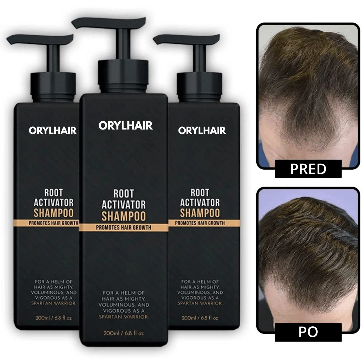 Orylo™ RootBoost Šampón na revitalizáciu vlasov - V2 (SK)