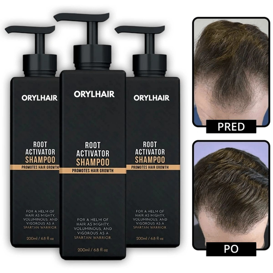 Orylo™ RootBoost Šampón na regeneráciu vlasov
