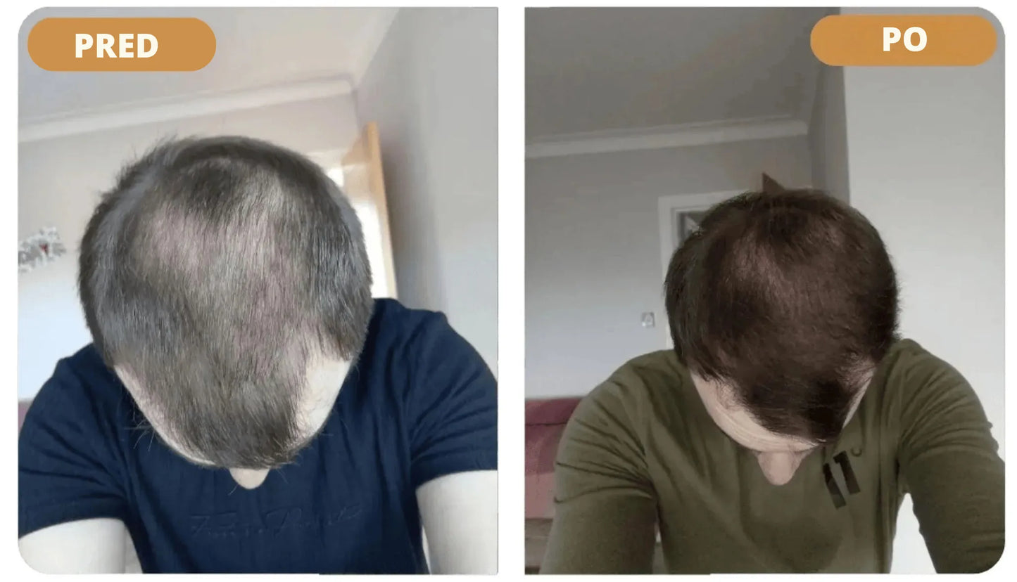 Orylo™ RootBoost Šampón na revitalizáciu vlasov - V2 (SK)