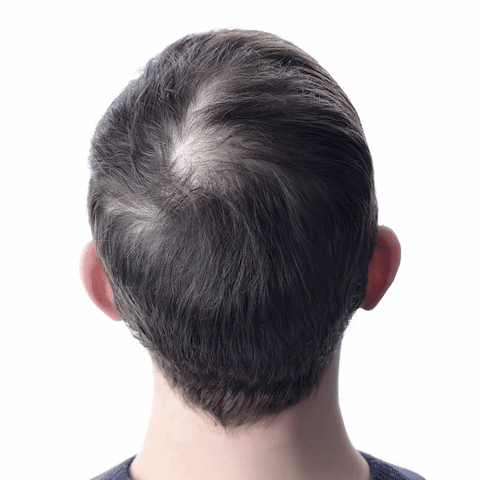 Orylo™ RootBoost Šampón na revitalizáciu vlasov - V2 (SK)