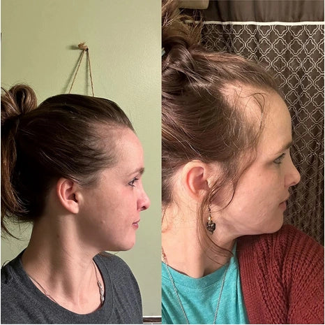 Bello Hair Growth Shampoo