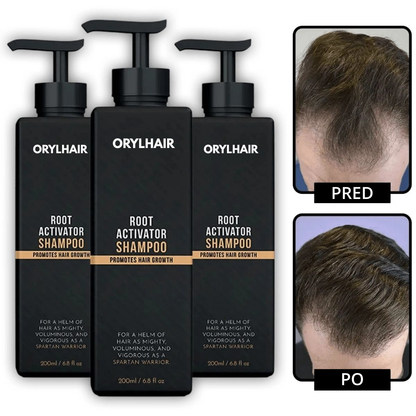 Orylo™ RootBoost Šampón na revitalizáciu vlasov - V2 (SK)