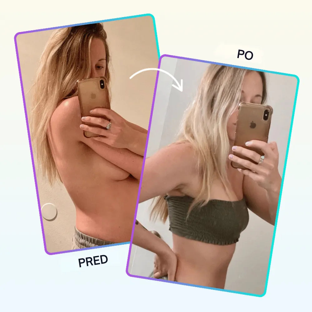 Landing Orylo™ GLP-1 Patch