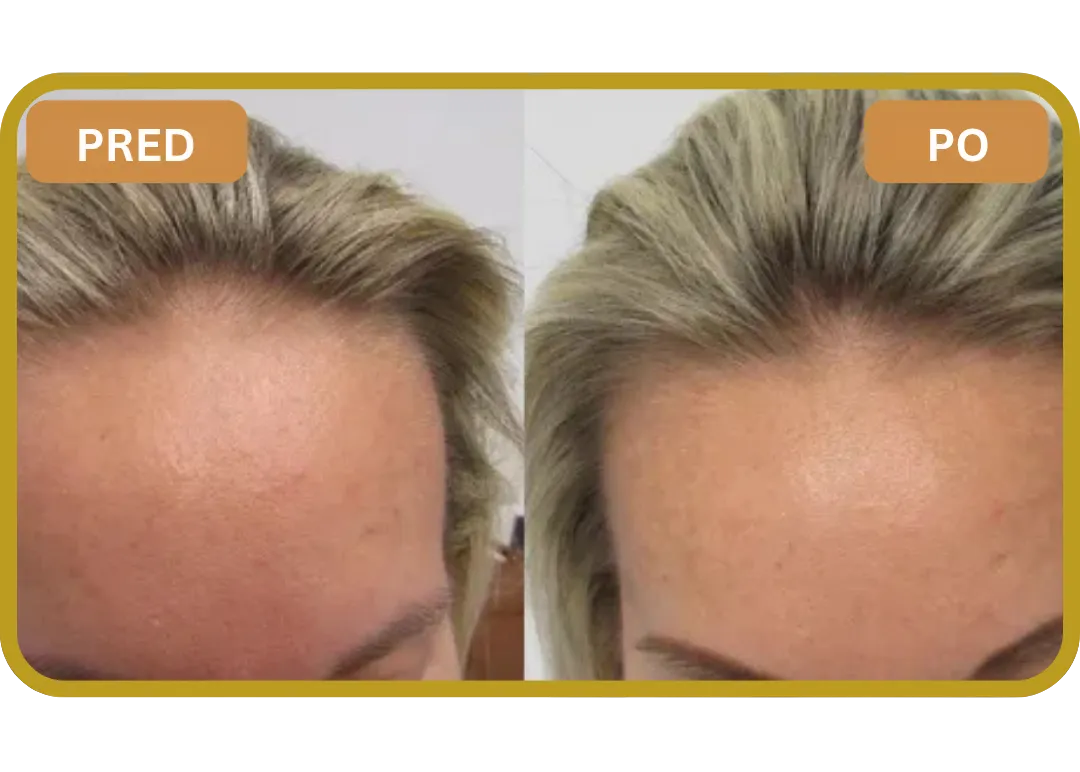 Orylo™ RootBoost Šampón na regeneráciu vlasov v2 (Women)