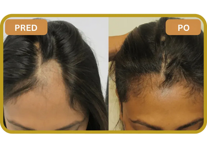 Orylo™ RootBoost Šampón na regeneráciu vlasov v2 (Women)