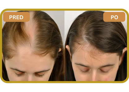 Orylo™ RootBoost Šampón na regeneráciu vlasov v2 (Women)