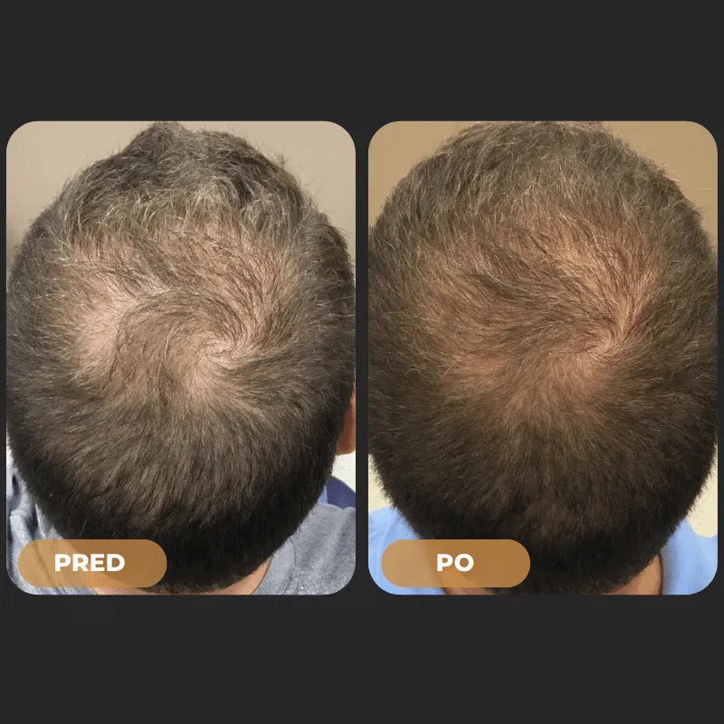 Orylo™ RootBoost Šampón na regeneráciu vlasov