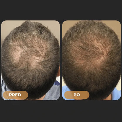 Orylo™ RootBoost Šampón na revitalizáciu vlasov - V2 (SK)