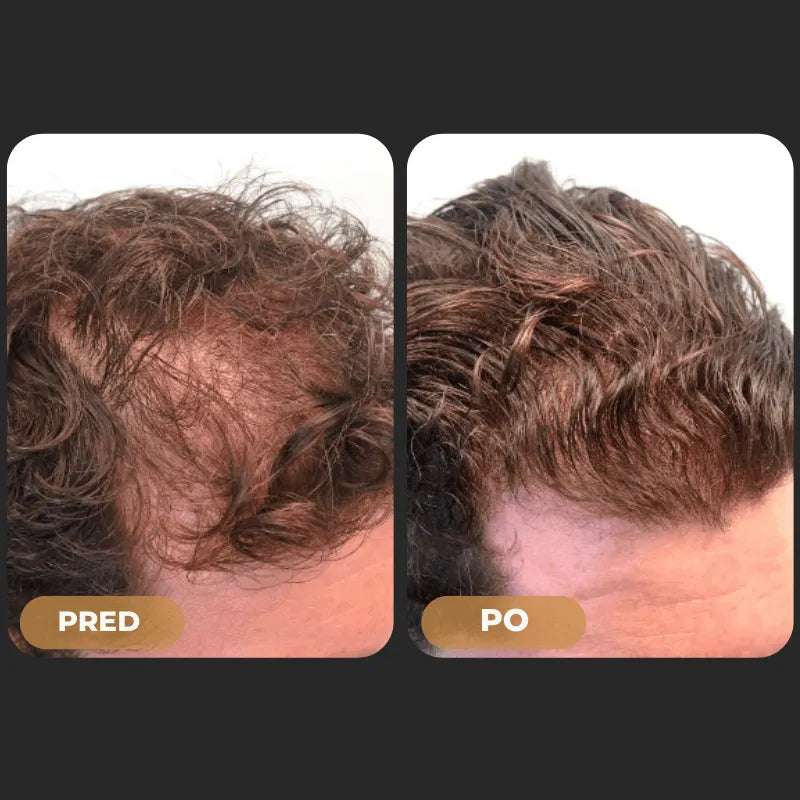 Orylo™ RootBoost Šampón na regeneráciu vlasov
