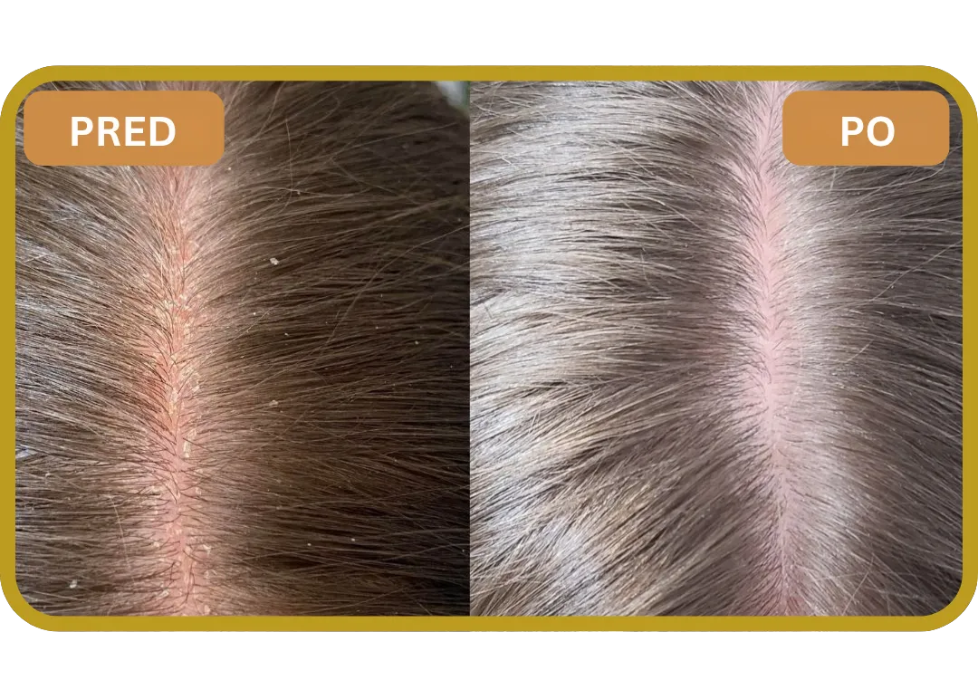 Orylo™ RootBoost Šampón na regeneráciu vlasov v2 (Women)