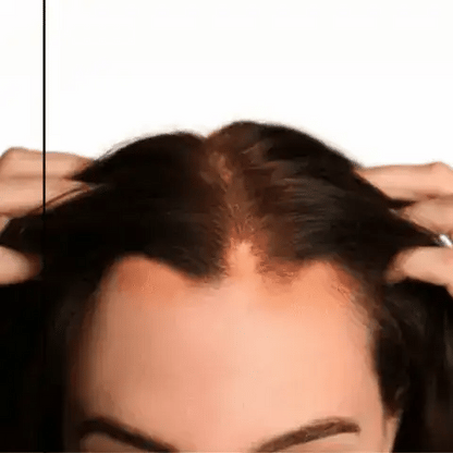 Orylo™ RootBoost Šampón na regeneráciu vlasov v2 (Women)